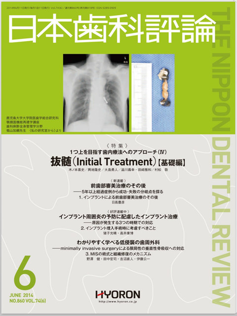 日本歯科評論 JUNE 2014 NO.860